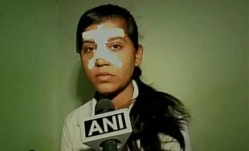 Resisiting sexual abuse: Kabaddi player assaulted in Kanpur