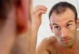 Reasons Why Men are Balding in Their 20s