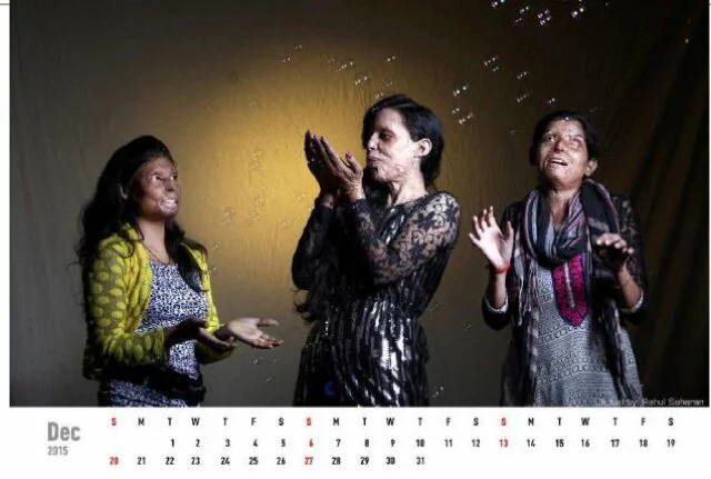 “Broaden the interpretation of beauty,” the calendar, an initiative to Stop Acid Attacks